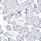 Anti-AGER Antibody