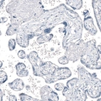 Immunohistochemical staining of human placenta shows no positivity in trophoblastic cells as expected.