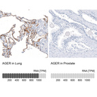 Anti-AGER Antibody