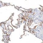 Immunohistochemical staining of human lung shows strong membranous positivity in pneumocytes.