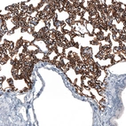 Immunohistochemical staining of rat lung shows strong membranous positivity in pneumocytes.