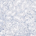 Immunohistochemical staining of human kidney shows no positivity in cells in tubules as expected.