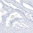 Immunohistochemical staining of human prostate shows no positivity in glandular cells as expected.