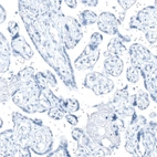 Immunohistochemical staining of human placenta shows no positivity in trophoblastic cells as expected.