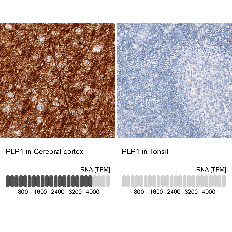 Anti-PLP1 Antibody