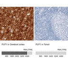 Anti-PLP1 Antibody
