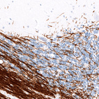 Immunohistochemical staining of human cerebellum shows strong positivity in myelinated neuronal processes.