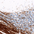 Immunohistochemical staining of human cerebellum shows strong positivity in myelinated neuronal processes.
