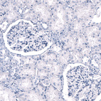 Immunohistochemical staining of human kidney shows no positivity as expected.