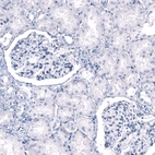 Immunohistochemical staining of human kidney shows no positivity as expected.
