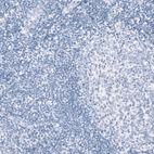 Immunohistochemical staining of human tonsil shows no positivity in lymphoid cells as expected.
