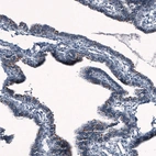 Immunohistochemical staining of human fallopian tube shows strong positivity in cilia in glandular cells.