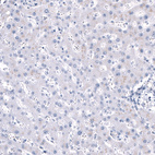 Anti-ANO2 Antibody