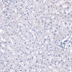 Immunohistochemical staining of human liver shows no positivity in hepatocytes as expected.