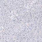 Immunohistochemical staining of human pancreas shows no positivity in exocrine glandular cells as expected.