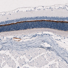 Anti-ANO2 Antibody