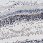 Immunohistochemical staining of human eye retina shows moderate positivity in the outer plexiform layer.