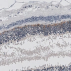 Immunohistochemical staining of human eye retina shows moderate positivity in the outer plexiform layer.