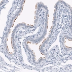 Immunohistochemical staining of human fallopian tube shows moderate positivity in cilia in glandular cells.
