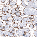 Immunohistochemical staining of human placenta shows strong cytoplasmic positivity in trophoblastic cells.