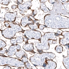 Immunohistochemical staining of human placenta shows strong cytoplasmic positivity in trophoblastic cells.