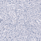 Immunohistochemical staining of human pancreas shows no positivity in exocrine glandular cells as expected.