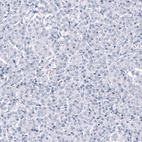 Anti-ANO2 Antibody