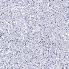 Immunohistochemical staining of human pancreas shows no positivity in exocrine glandular cells as expected.