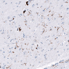 Anti-CD163 Antibody