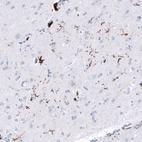 Immunohistochemical staining of human cerebral cortex (Alzheimers disease) shows strong cytoplasmic positivity in perivascular macrophages and in microglia.