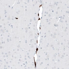Immunohistochemical staining of rat cerebral cortex shows strong cytoplasmic positivity in perivascular macrophages.