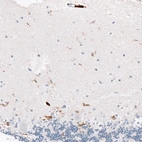 Immunohistochemical staining of human cerebellum shows moderate cytoplasmic positivity in microglia and strong staining in perivascular macrophages.