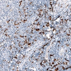 Immunohistochemical staining of human tonsil shows strong cytoplasmic positivity in non-germinal center cells.