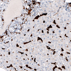 Immunohistochemical staining of human liver shows strong cytoplasmic positivity in Kupffer cells.