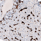 Anti-CD163 Antibody