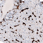 Immunohistochemical staining of human liver shows strong cytoplasmic positivity in Kupffer cells.