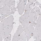 Immunohistochemical staining of human skeletal muscle shows no positivity in myocytes as expected.