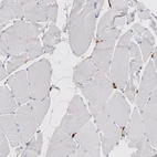 Immunohistochemical staining of human skeletal muscle shows no positivity in myocytes as expected.