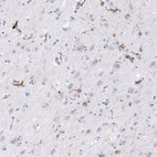 Immunohistochemical staining of human cerebral cortex shows strong cytoplasmic positivity in perivascular macrophages as well as moderate positivity in microglia.