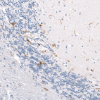 Anti-CD163 Antibody