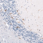 Immunohistochemical staining of human cerebellum shows moderate cytoplasmic positivity in microglia.