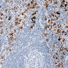 Anti-CD163 Antibody