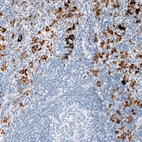 Immunohistochemical staining of human lymph node shows strong cytoplasmic positivity in non-germinal center cells.