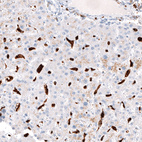 Immunohistochemical staining of human liver shows strong cytoplasmic positivity in Kupffer cells.