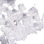 Immunohistochemical staining of human skeletal muscle shows no positivity in myocytes as expected.