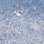 Immunohistochemical staining of human spleen shows strong cytoplasmic positivity in a subset of cells in red pulp.