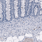 Anti-GZMB Antibody