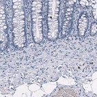 Immunohistochemical staining of human rectum shows strong cytoplasmic positivity in a subset of lymphoid cells.