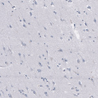 Immunohistochemical staining of human cerebral cortex shows no positivity in neurons as expected.