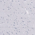 Immunohistochemical staining of human cerebral cortex shows no positivity in neurons as expected.